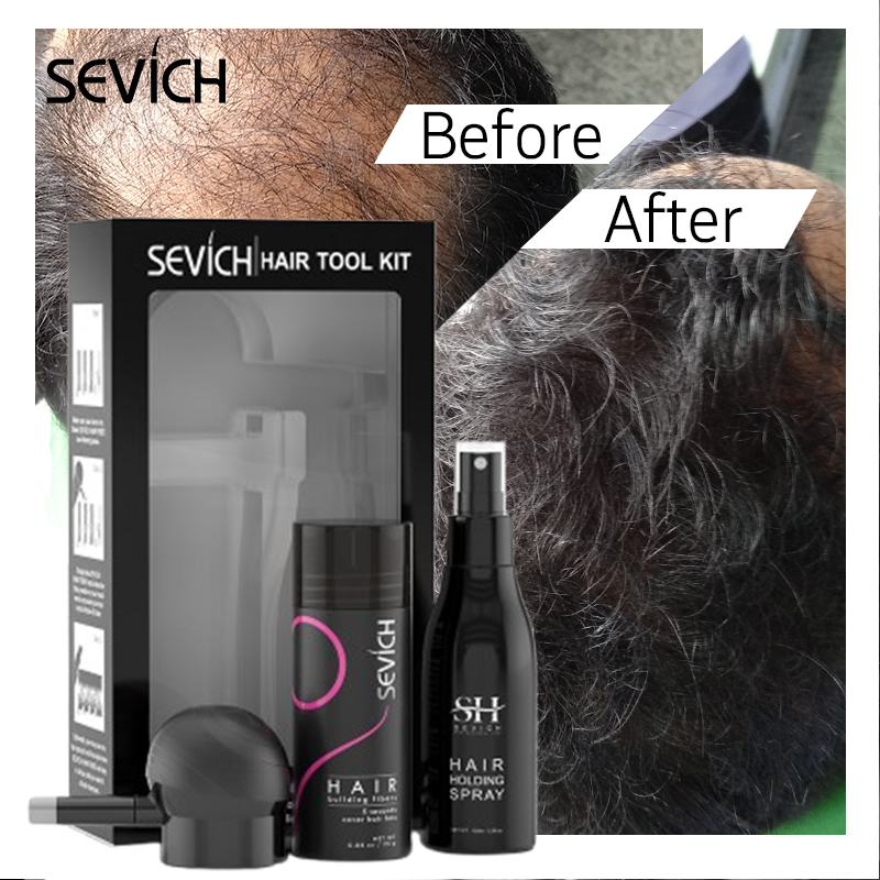 Keratin Treatment Set - Serat Rambut Hitam Set Serat Penumbuh