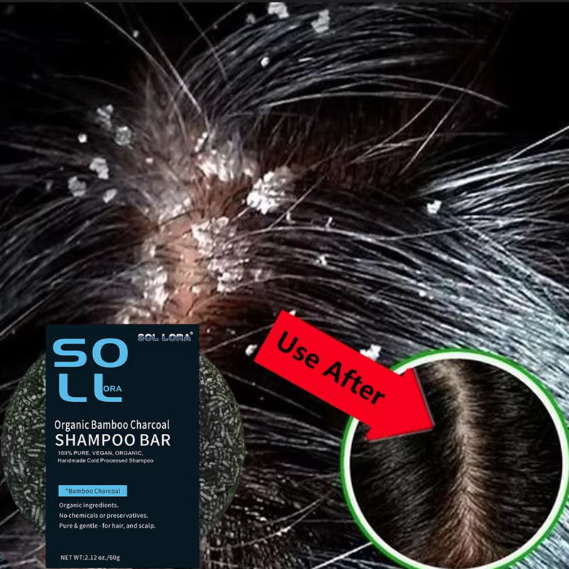 Hair Care Dandruff - Sabun Perawatan Rambut Anti Ketombe Cepat