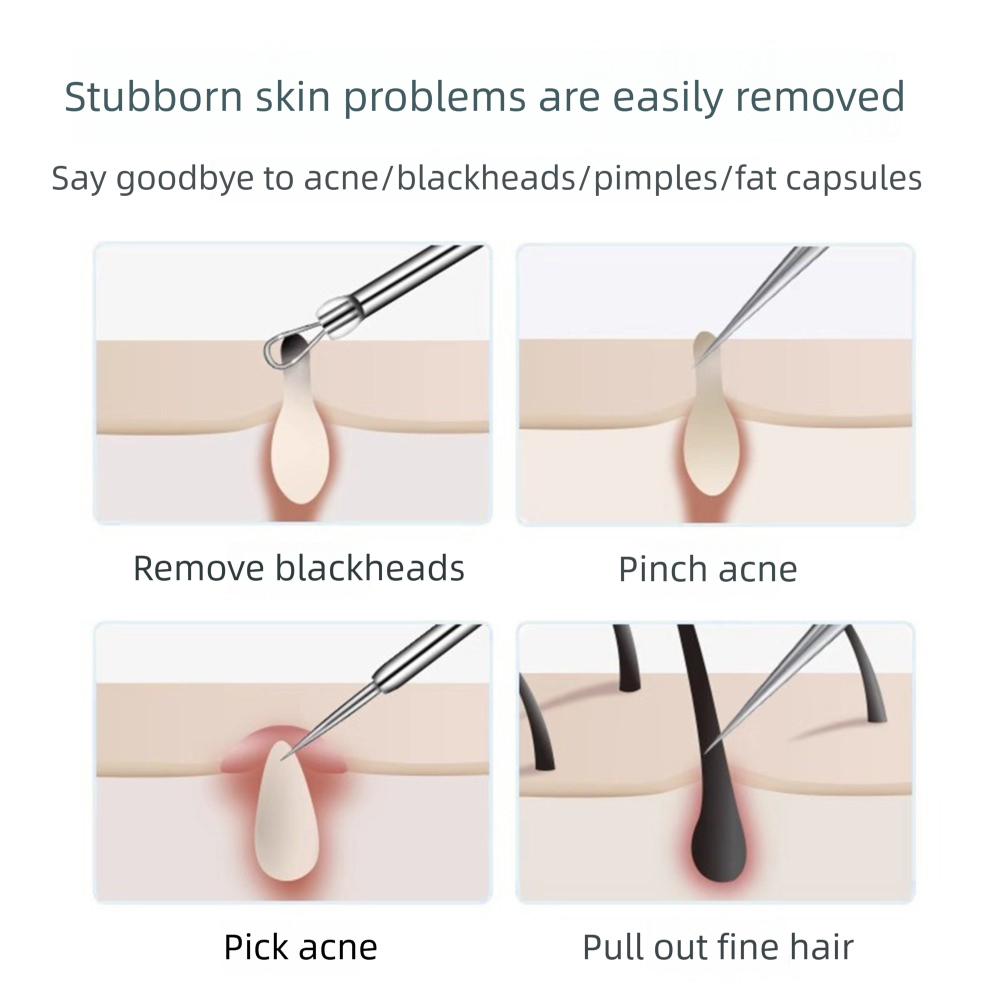 3-5pcs Ingrown Hair Tweezers A - Hair Care Clinic ulasan dan harga