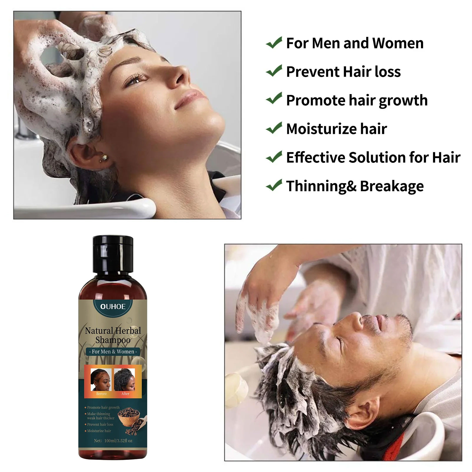 OUHOE Sampo Penumbuh Rambut Pe - Hair Care Dandruff ulasan dan harga