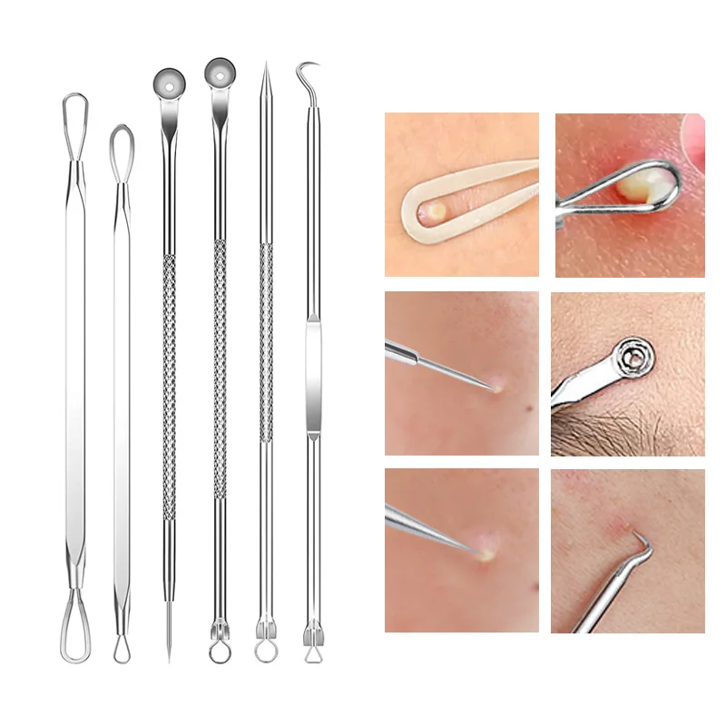 4-11 buah pinset Perawatan Kul - Hair Care Clinic ulasan dan harga