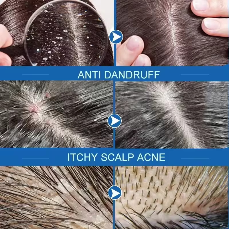 Sabun Perawatan Rambut Anti Ke - Hair Care Dandruff ulasan dan harga