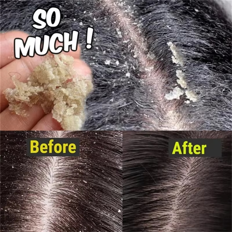 Sabun Perawatan Rambut Anti Ke - Hair Care Dandruff ulasan dan harga
