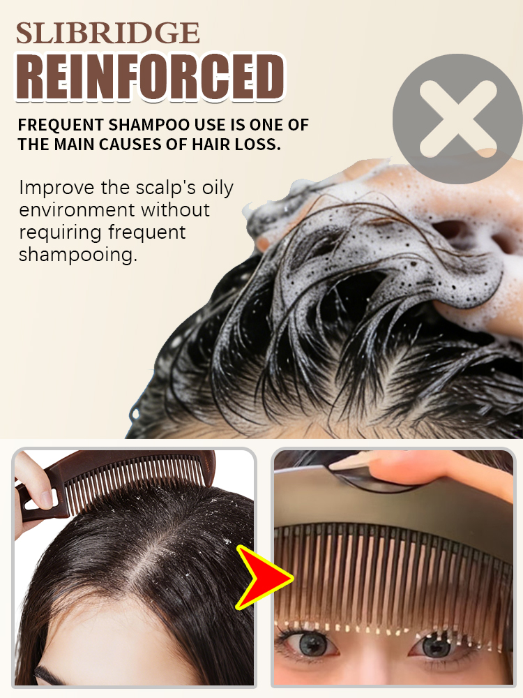 Sisir Penghilang Minyak Kulit  - Hair Care Dandruff ulasan dan harga