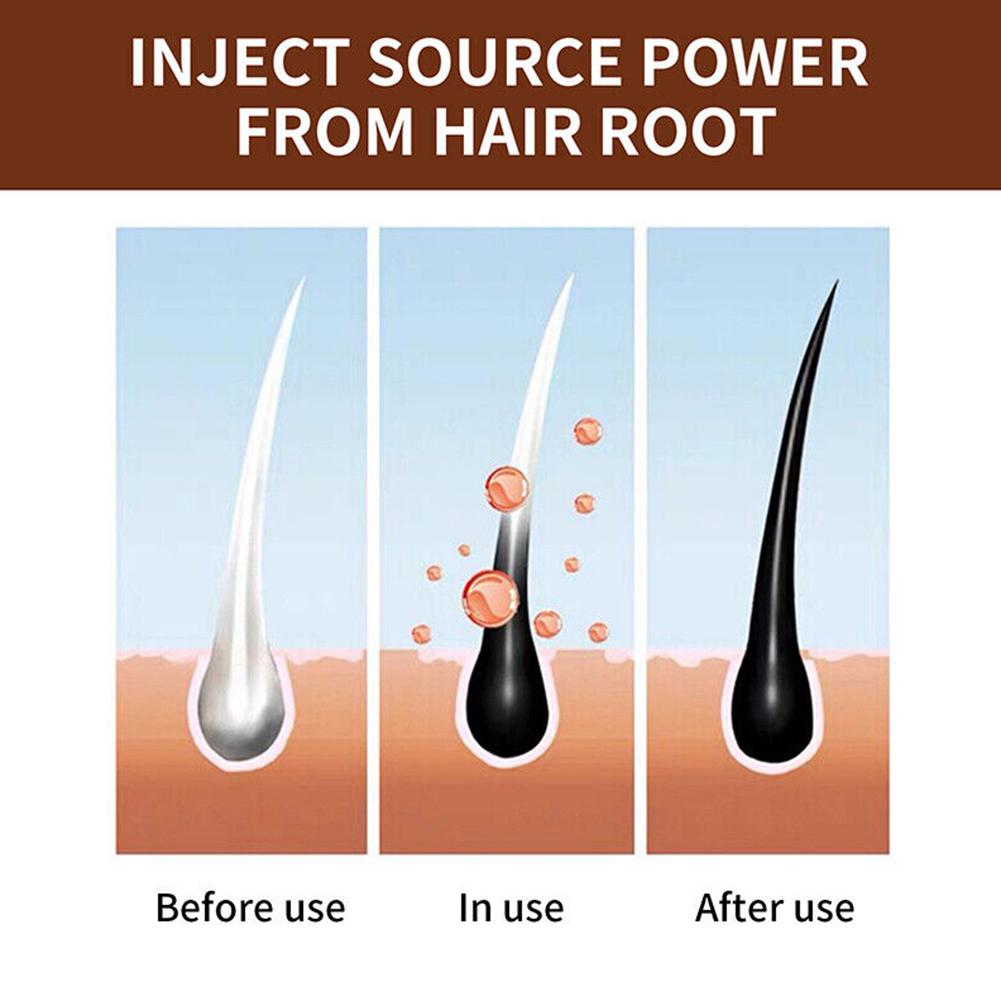 Sabun Polygonum Alami Buatan T - Hair Care Dandruff ulasan dan harga